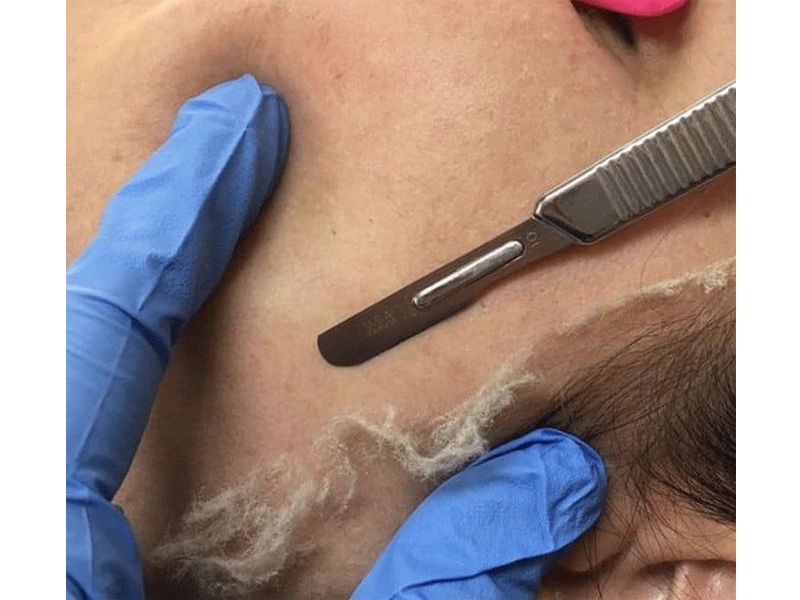 کلینیک تخصصی پوست و مو راویس در مشهد