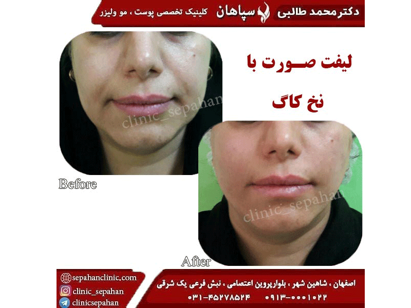 کلینیک تخصصی پوست و مو سپاهان در اصفهان