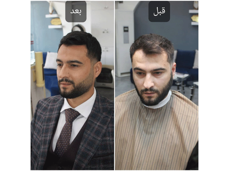 آرایشگاه مردانه آلما در مشهد