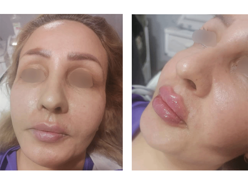 کلینیک پوست و مو دکتر مریم هاشمی در مشهد