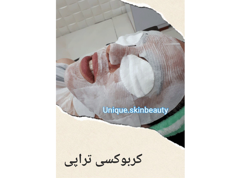 آموزش فشیال پوست مرضیه صادق پور در تهران