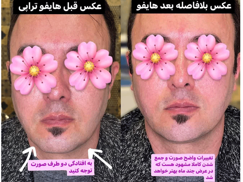 کلینیک زیبایی پوست و مو دکتر برزگر جلالی در تبریز