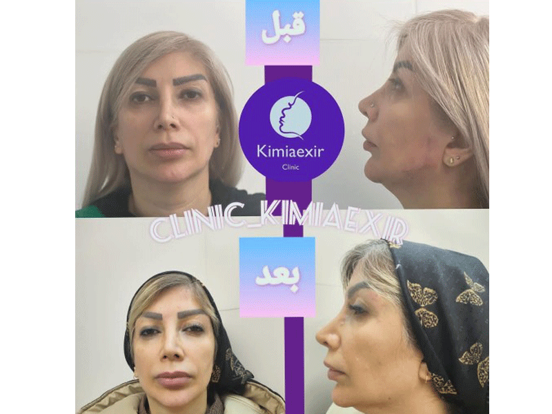کلینیک زیبایی کیمیا اکسیر در تهران