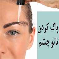 متخصص در پاک کردن تاتو چشم در مشهد