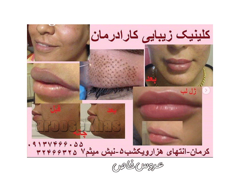 کلینیک پوست و موی کارا درمان در کرمان