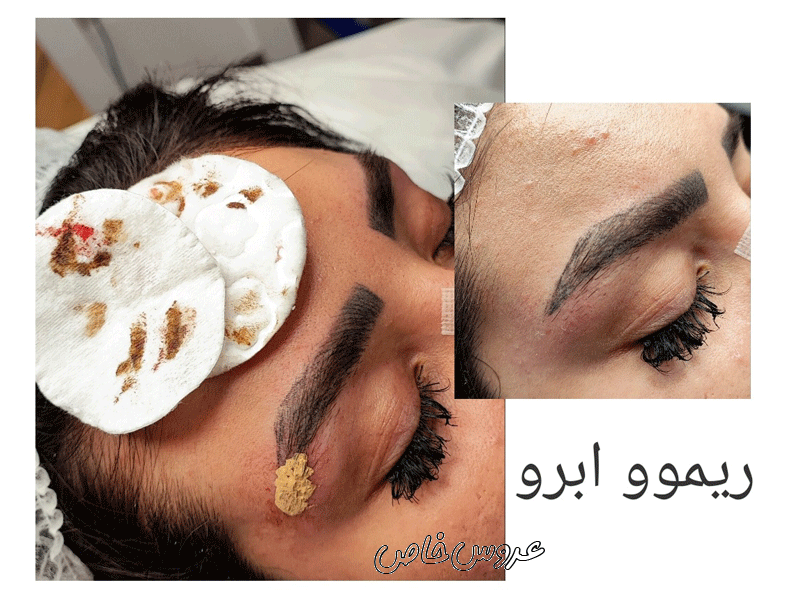 میکروبلیدینگ و آرایش دائم فاطمه در مشهد