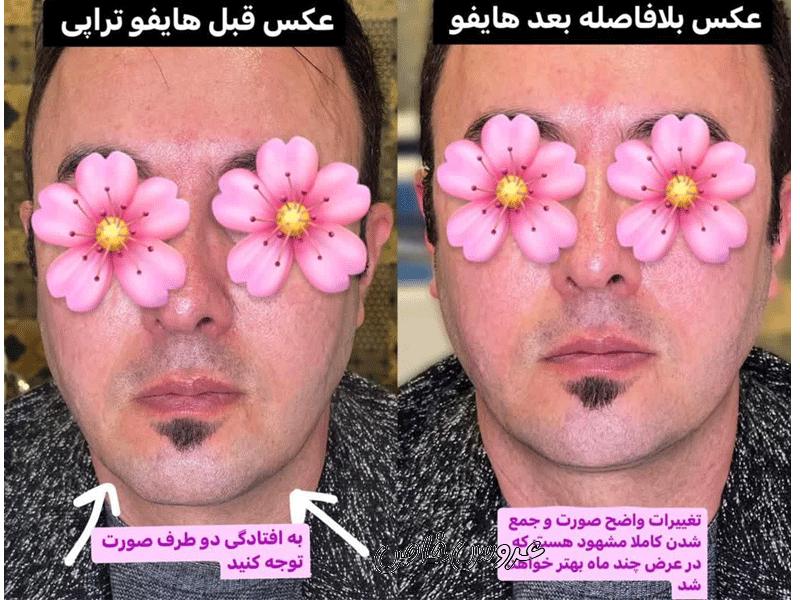 کلینیک زیبایی پوست و مو دکتر برزگر جلالی در تبریز